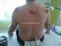  KONYA HACAMAT hacamat konyada hacamat