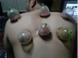  UZMAN hacamat kursu eğitimi sülük kursu Konya